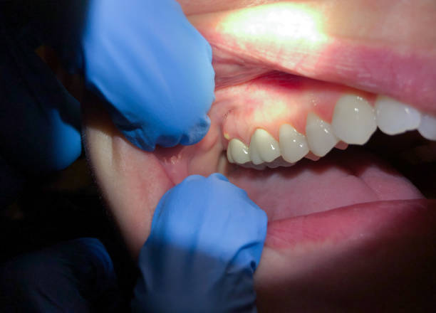 Best Urgent Tooth Repair  in Whitaker, PA